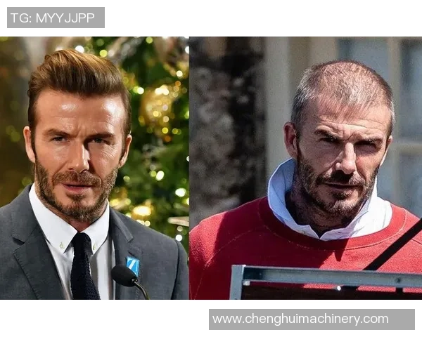 足球明星秃头风采大盘点：从贝克汉姆到C罗，他们如何演绎独特魅力